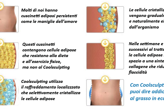 coolsculpting come funziona