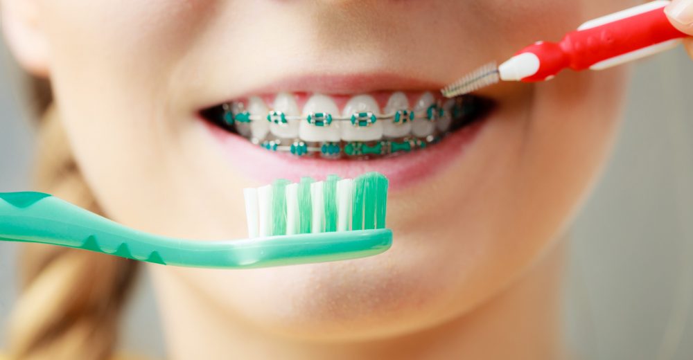 come-pulire-apparecchio