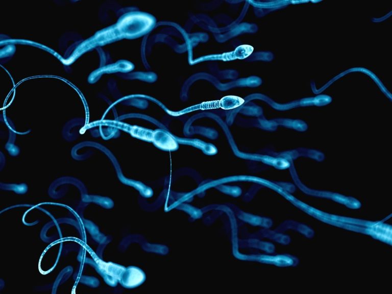 infertilita maschile