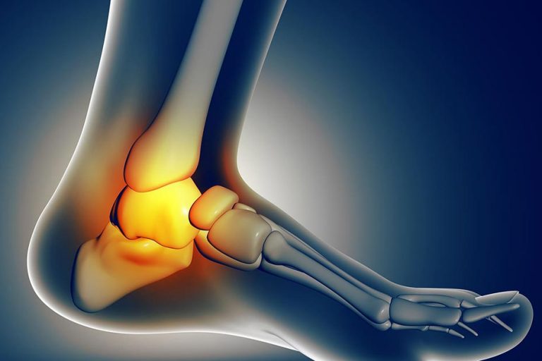 distorsione caviglia cause rimedi