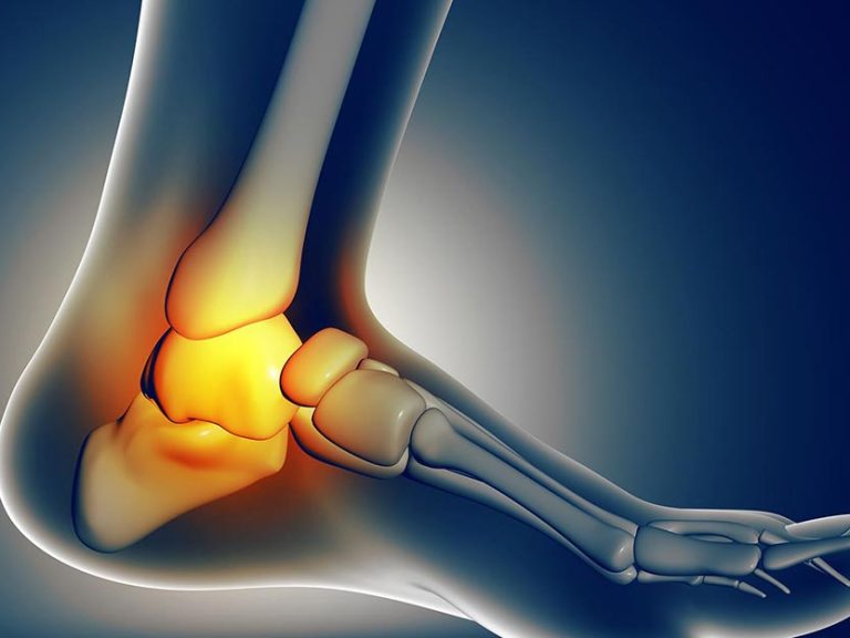 distorsione caviglia cause rimedi