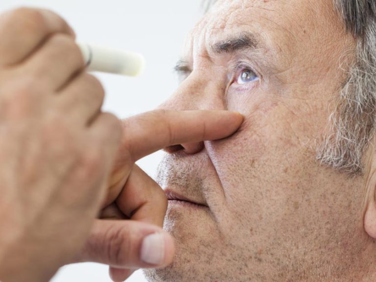 glaucoma prevenzione