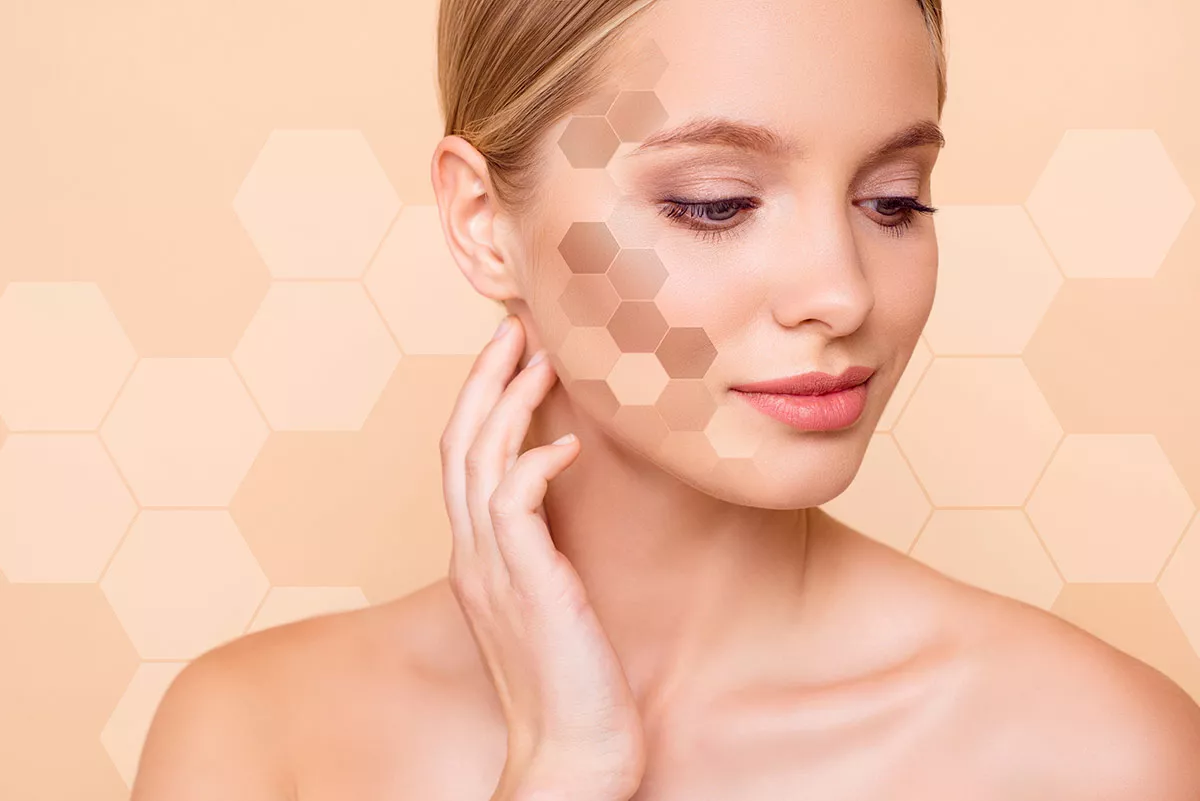 biostimolazione collagene